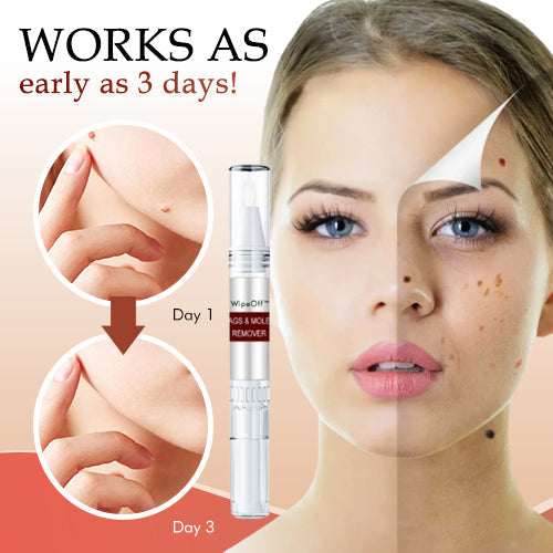 đ„Promotion 65% OFFđ„WipeOff recommends Tags & Moles Remover