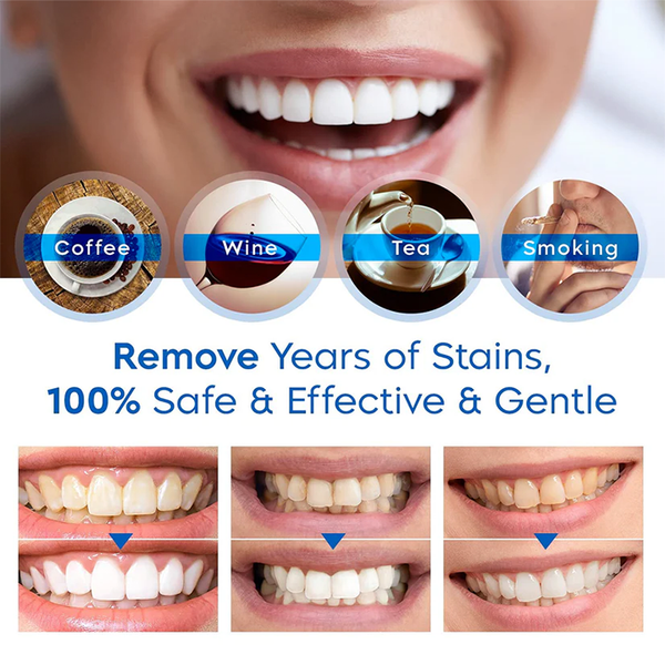 🔥Last Day 49% OFF Teeth Whitening Essence